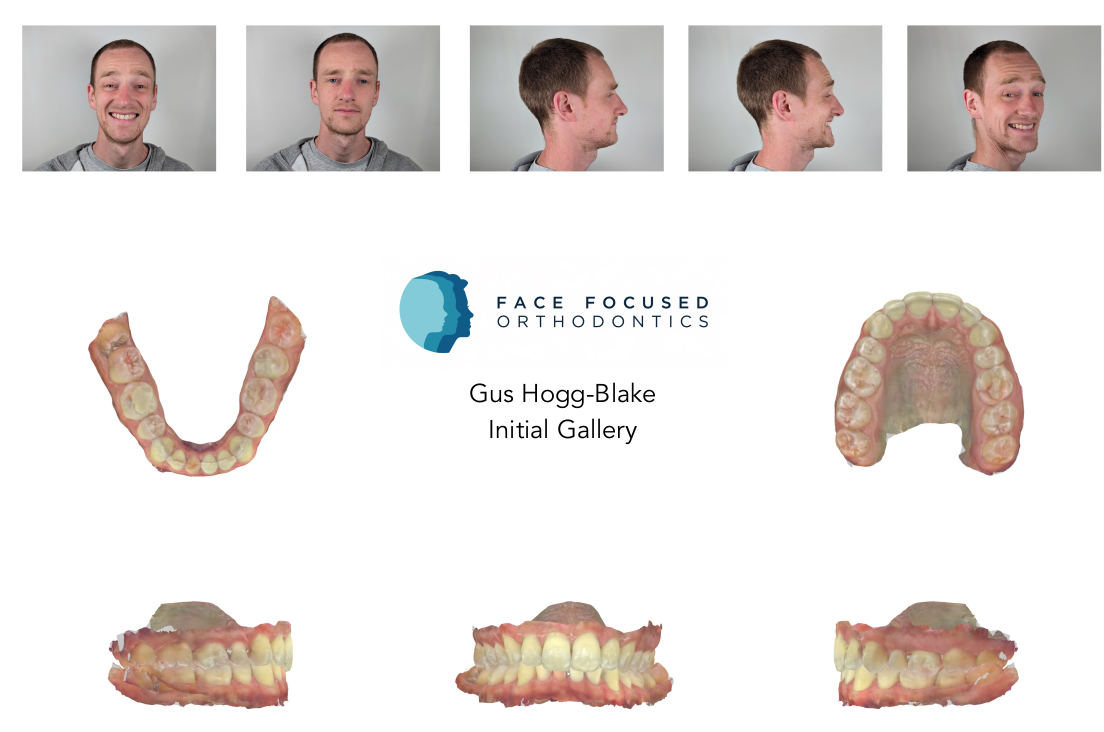 Face Focused Initial Gallery